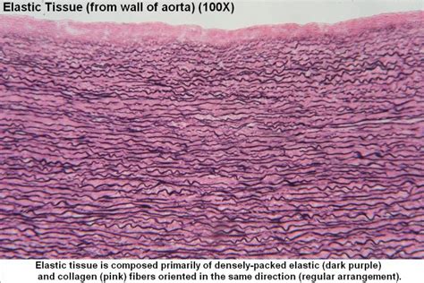 Elastic Tissue – Tutorial – Histology Atlas for Anatomy and Physiology