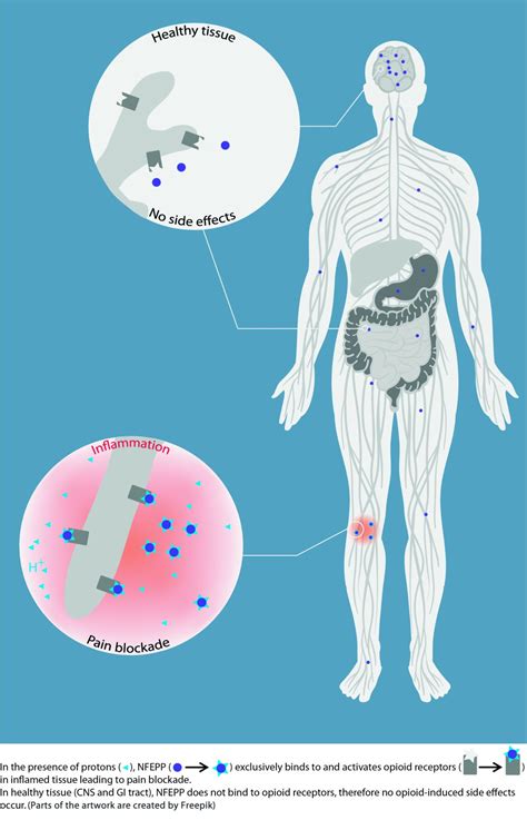 Opioid Acts Only on Hurt Tissues, Skips Side Effects