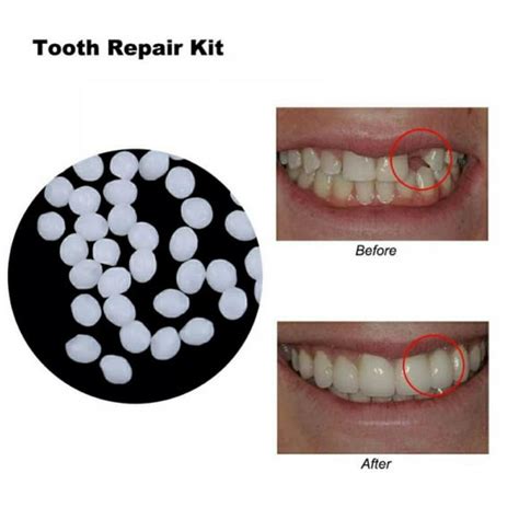 Denture Repair Glue