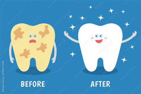 Before And After Teeth Cleaning Cartoon