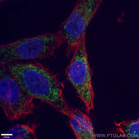 Cytochrome c antibody (66264-1-Ig) | Proteintech