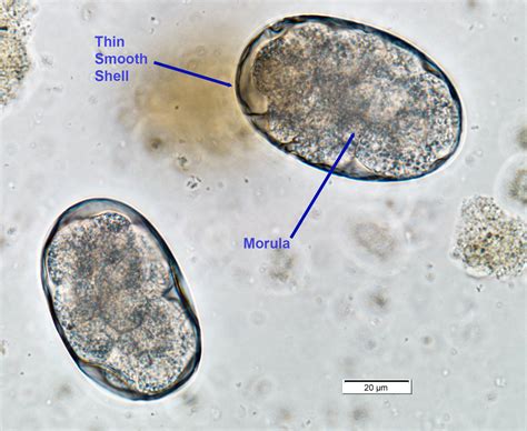 Ancylostoma Braziliense Morphology