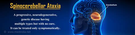 Spinocerebellar Ataxia - Types, Causes, Symptoms, Diagnosis, Treatment ...