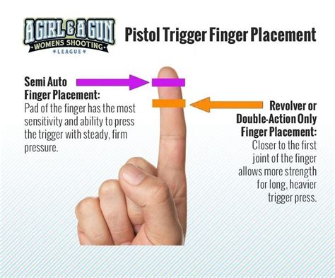 Trigger Finger Placement Chart