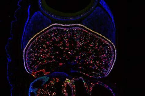 A new map of the octopus visual system gives clues to brain evolution