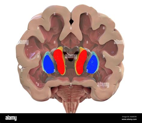 Illustration of the basal ganglia showing the caudate nucleus (red), putamen (blue), and lateral ...