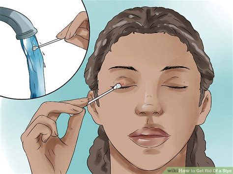 How to Get Rid Of a Stye: 11 Steps (with Pictures) - wikiHow