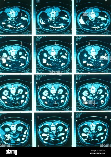 Abdominal scan hi-res stock photography and images - Alamy