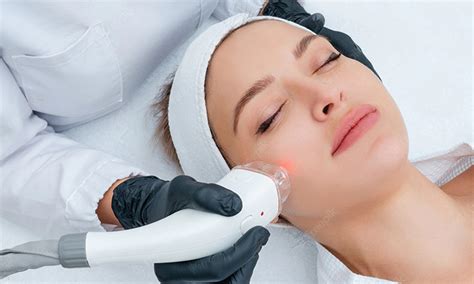 IPL Photofacial Vs BroadBand Light (BBL): What's The Difference?