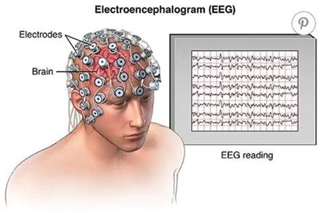 EEG AND BRAINWAVES - BRIGHT BRAIN - LONDON'S EEG, NEUROFEEDBACK AND BRAIN STIMULATION CENTRE