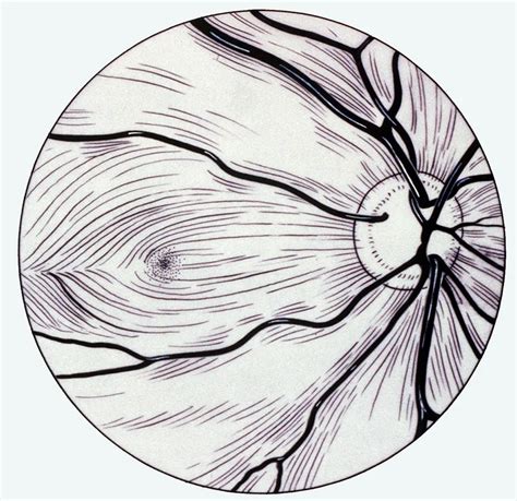 Retinal nerve fiber layer - American Academy of Ophthalmology