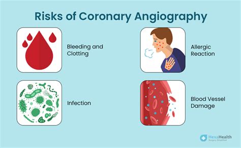 Coronary Angiography - Procedure, Purpose, Risks, Results