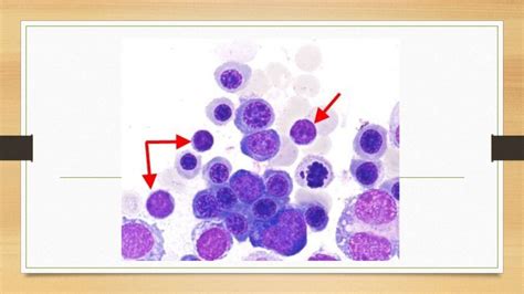 NRBC - Nucleated Red Blood Cells