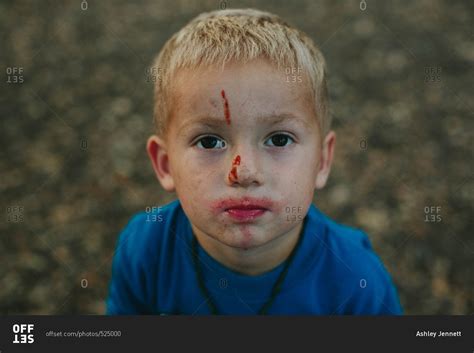 Boy with a bloody face stock photo - OFFSET