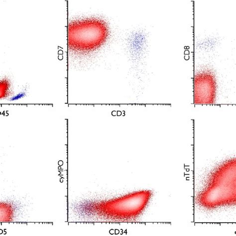 B lymphoblastic leukemia, typical immunophenotype. Blasts are shown in... | Download Scientific ...