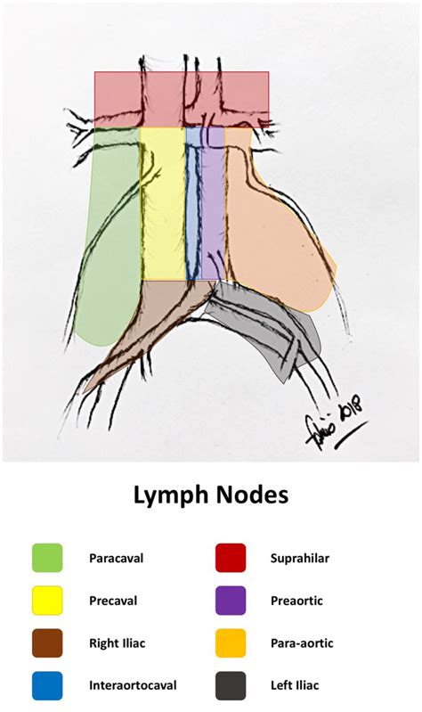 | Retroperitoneal lymph node areas (original drawing by the author). | Download Scientific Diagram