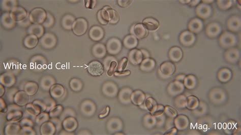 Red Blood Cells Microscope Labeled