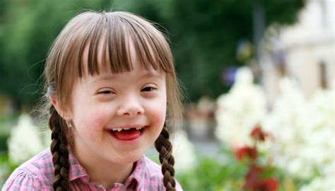 Down Syndrome Symptoms - Health Info