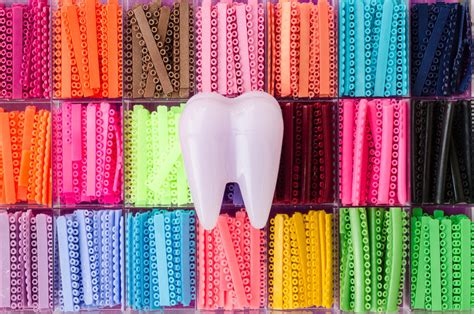 What Will Wearing Braces Be Like? - Belmar Orthodontics