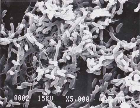 Scanning Electron Microscope Photo of Vibrio Bacteria X5000 Stock Image - Image of medicine ...