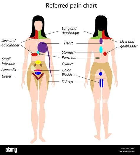 Referred pain chart Stock Photo - Alamy