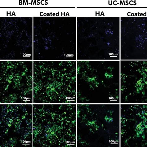 The representative fluorescent micrographs illustrate the actin... | Download Scientific Diagram