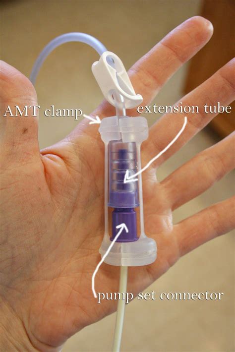 AMT clamp=no more G tube/GJ tube/J tube leakage! | Gtube, Feeding tube ...