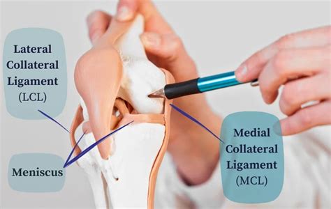 ACL Vs MCL Vs Meniscus Tear | Dr. Pamela Mehta, San Jose