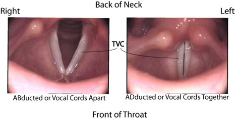 What to Do and Care After Vocal Cord Surgery