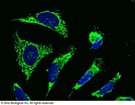 Anti-Citrate Synthase Antibody, Rabbit PAb, 14083-T46 | Sino Biological