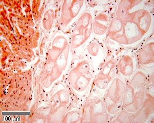 Histology of Purkinje fibres ~ University Notes