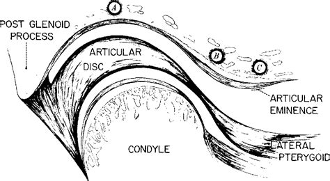 Figure 2 from Histological changes in the articular eminence and ...