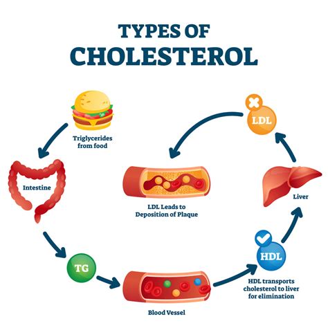 New PCSK9 Inhibitors Treat High Cholesterol - Suzy Cohen, RPh offers natural remedies to help ...