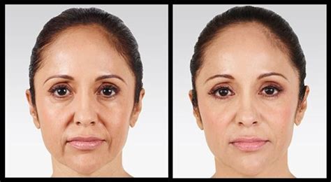 Check out the before and after photos of patients with successful ...