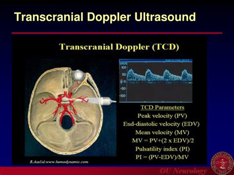 PPT - Introduction to Carotid Ultrasound and Transcranial Doppler Ultrasound PowerPoint ...