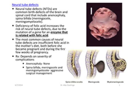 Meningomyelocele