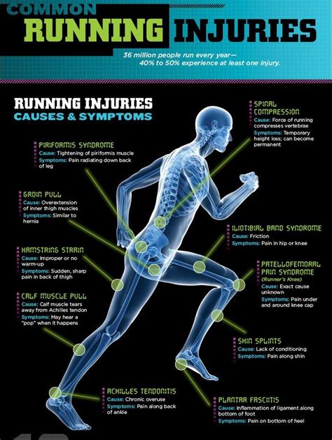 Running injuries | Running injury prevention, Running injuries, Sports therapy