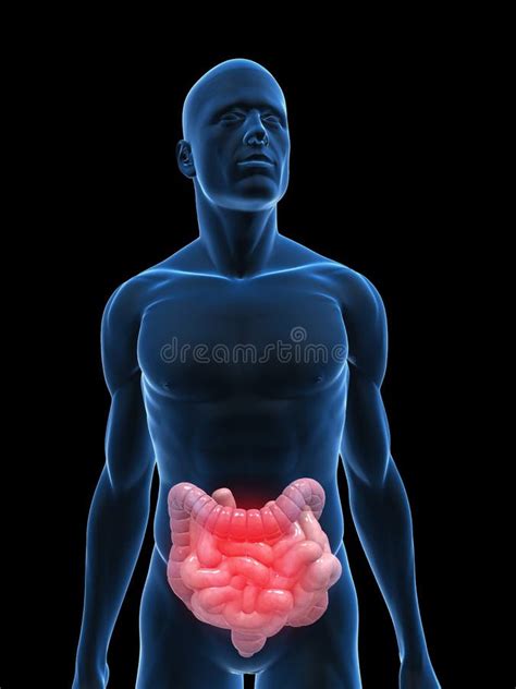 Inflamed intestines stock illustration. Illustration of human - 10245682