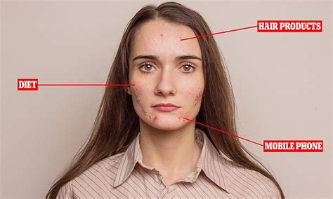 Expert reveals the causes of bad skin on different parts of the face | Daily Mail Online