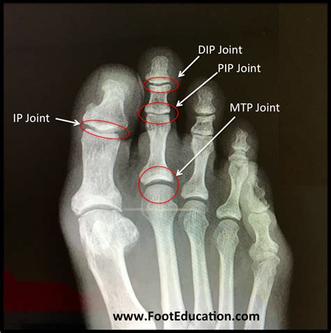 Bones and Joints of the Foot and Ankle Overview - FootEducation