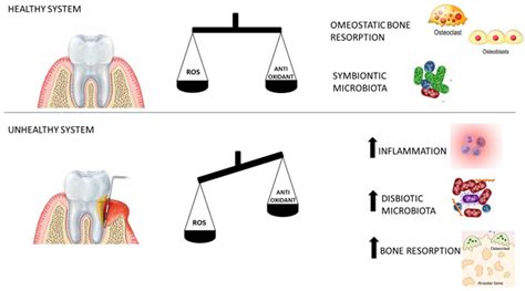 The Emerging Role of Salivary Oxidative Stress Biomarkers as Prognostic Markers of Periodontitis ...