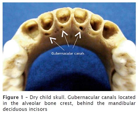 Gubernacular cord and canal: does these anatomical structures play a role in dental eruption?