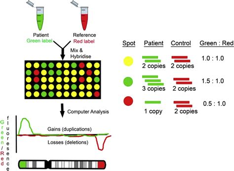 The use of chromosomal microarray for prenatal diagnosis - American Journal of Obstetrics ...