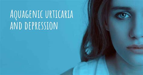 Aquagenic urticaria and depression