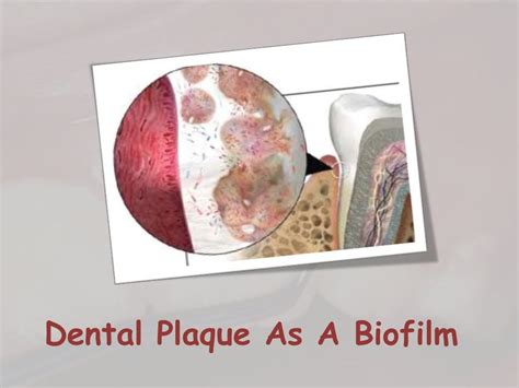 Dental plaque formation