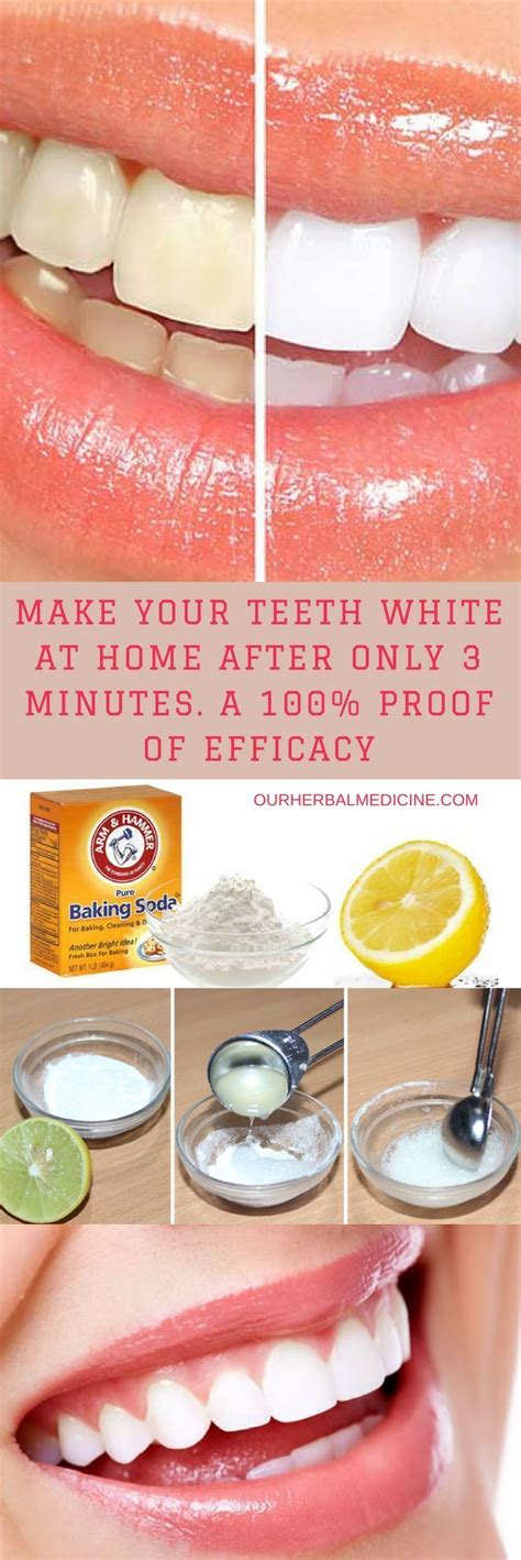 How To Get Rid Of White Spots On Teeth Fab How - Reverasite