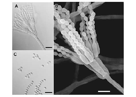 Penicillium sp. FKI-1938 on CYA. (A) Biverticillate penicilli under a... | Download Scientific ...