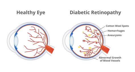 Lehigh Eye Specialists