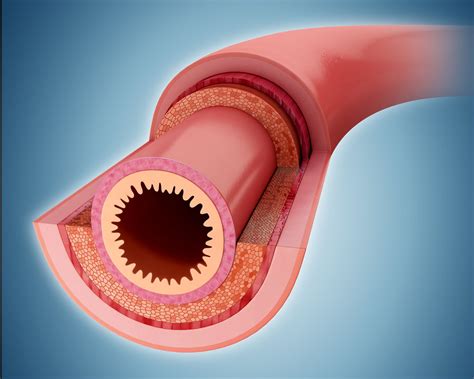 The Narrowing of Lumen in the Intestines