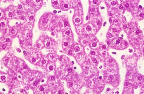 Liver, Hepatocytes, LM - Stock Image - C050/3235 - Science Photo Library